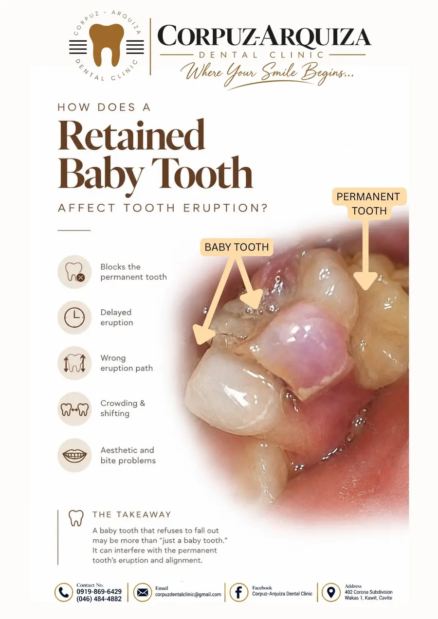 Clinic post: how a retained baby tooth can affect the permanent tooth